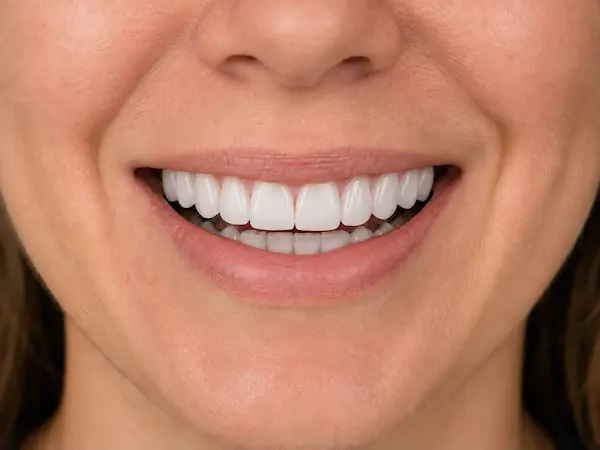 DentalPro Facing behandeling erna