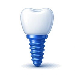 Implantaat DentalPro Icoon Implantaat DentalPro Icoon